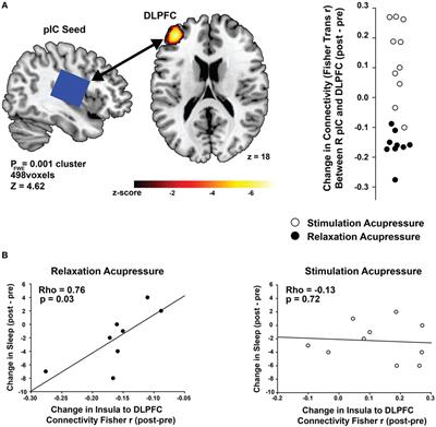 Brain Connectivity Patterns Dissociate Action of Specific Acupressure Treatments in Fatigued Breast Cancer Survivors